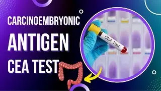 Carcinoembryonic Antigen Test | CEA Blood Test | Tumor Marker