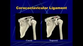 Anatomy of the coracoclavicular ligament; Trapezoid and conoid ligaments