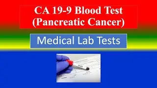 CA 19 9 Blood Test Pancreatic Cancer - Medical  Lab Tests - What is? , Uses, Preparation, Results