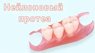 Нейлоновый полный СЪЕМНЫЙ протез.