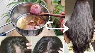 I tried this and my hair growth got doubled in 1 month-Increase Hair Density with Double Hair Growth