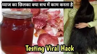 Testing Viral प्याज के छिल्के से बना Onion Hair Tonar Hack | Instant Homemade Hair Growth Tonar