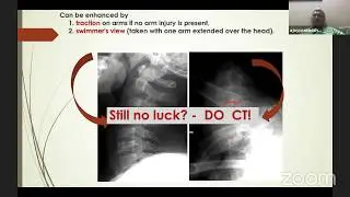 Cervical Spine Injury