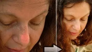 Photoshop CS6: How To Get Rid of Acne, Pimples, Wrinkles, Sunspots, [Flawless Skin P1]