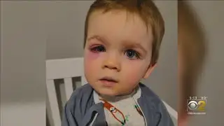Mom Warns Parents After Toddler Nearly Lost Eyesight From Playing With Squirting Bath Toys