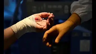Как убивает коронавирус? Лечащие врачи сообщают об огромном ущербе всему организму, от мозга до паль