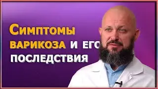 Почему варикоз — это бомба замедленного действия? Узнайте, как спасти свои ноги. Лучшие советы врача