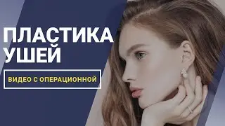 Пластика ушей  | ВИДЕО С ОПЕРАЦИОННОЙ |