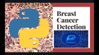 Breast Cancer Prediction Using Machine Learning | Python