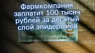 Фармкомпания заплатит 100 тысяч рублей за десятый слой эпидермиса