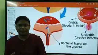 Urinary Tract Infection  Classification of UTI Drugs / SAR of Quinolones L-3 Medi Chemistry 6th sem