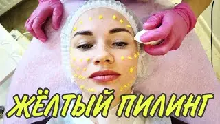 💛ЖЁЛТЫЙ ПИЛИНГ | УХОД ЗА КОЖЕЙ ПОСЛЕ 30 | ИДУ К КОСМЕТОЛОГУ В КРАСНОДАРЕ