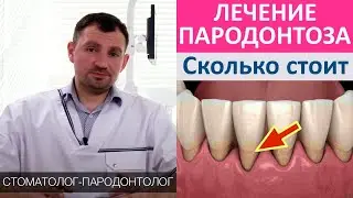 Стоимость лечения пародонтоза. Существует ли на пародонтоз и как он связан с остеопарозом?