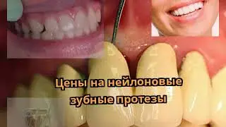 Цены на нейлоновые зубные протезы