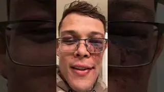 Caio Borralho shows of brutal cut from Jared Cannonier fight