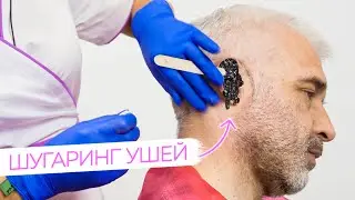 Шугаринг УШЕЙ мужчине | Мужская депиляция от Яны Осадчей