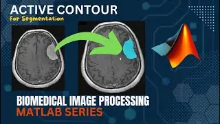 Snakes...for quick Image segmentation | Active contour tutorial