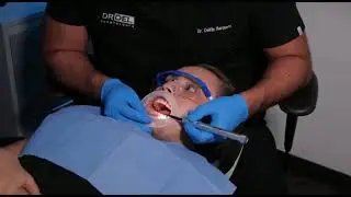 Addent Microlux MMDENTAL Youtube