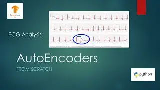 Anomaly Detection with AutoEncoders using Tensorflow