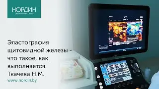 Эластография щитовидной железы