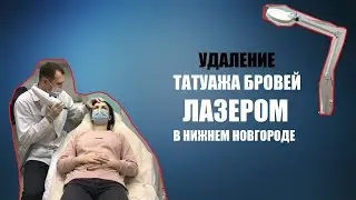 УДАЛЕНИЕ ТАТУАЖА БРОВЕЙ ЛАЗЕРОМ в НИЖНЕМ НОВГОРОДЕ