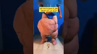 عقلي لا يصدق ما حدث لهذا الرجل حتى هذه اللحظة ـ مدهش للغاية #shorts