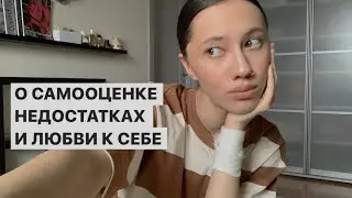 ПОЛЮБИ СВОИ НЕДОСТАТКИ / Самооценка и любовь к себе