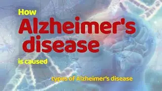 What causes Alzheimer's Disease  | Types of Alzheimer's Disease