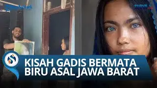 KISAH EVI, Gadis Bermata Biru Asal Jawa Barat, Incaran FOTOGRAFER Dunia: Tak Punya Keturunan Bule