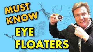 What your EYE DOCTOR hasn't TOLD you:  EYE FLOATERS EXPLAINED