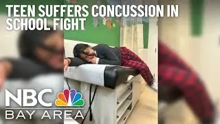 San Jose Family Wants Answers After Teen Suffers Concussion in School Fight