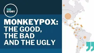 Monkeypox: The good news and bad news about this latest global health emergency