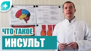 Что такое инсульт. Симптомы инсульта.