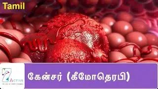 புற்றுநோய் ( கீமோதெரபி ) | Cancer (Chemotherapy) | Tamil