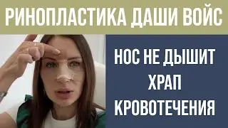 РИНОПЛАСТИКА У DASHA VOICE ⚡ НЕ ДЫШИТ НОС ⚡ ВСЕ СТАДИИ ШОКА