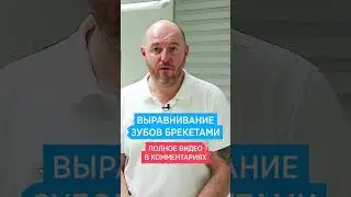 Выравнивание зубов брекетами 🦷 Как работают брекеты