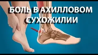 Что делать с болью в ахилловом сухожилии? Спасаем мир с доктором Демченко. Лечение беговых травм.