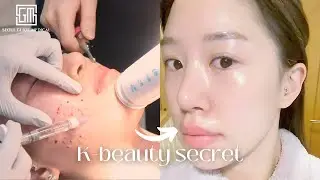 Trying Korean Anti-aging Secret That Has Gone Viral | Seoul Guide Medical