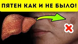 100% эффект! Быстро и дешево выведи пигментные пятна с кожи!