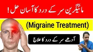 Migraine Treatment - Migraine Ka ilaj In Urdu Hindi - माइग्रेन का इलाज - Dr Irfan Azeem