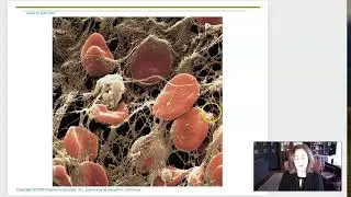 Week 6 Lecture 3 Platelets, blood clot, ABO, Rh