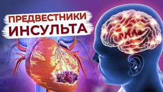 Предвестники  инсульта