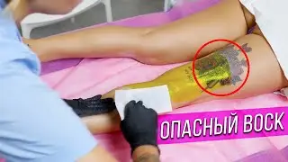 Опасный воск! Какие последствия могут быть от ВАКСИНГА?