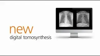 What's New - Innovative Digital Tomosynthesis