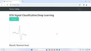 Deep learning project: ECG signal classification