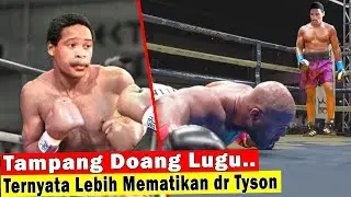 Bocah 17 Tahun Jadi Juara Dunia‼ Jauh Lebih Hebat Dr Mike Tyson Muda, Tapi Lihat Akhir Kariernya....