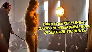 KISAH NYATA GADIS MIRIP “SINGA” INI DI8ULLY, 10 TAHUN KEMUDIAN SEMUANYA DIBUAT TERKEJUT..