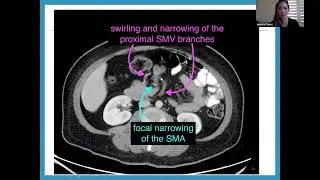 SAGES Bariatrics for General Surgeons