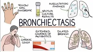 Diploma in Pulmonology :Asthma, COPD, pneumonia, bronchiectasis, CF, mediastinum, ARDS, neoplasms