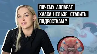 Почему аппарат Хааса нельзя ставить подросткам❓